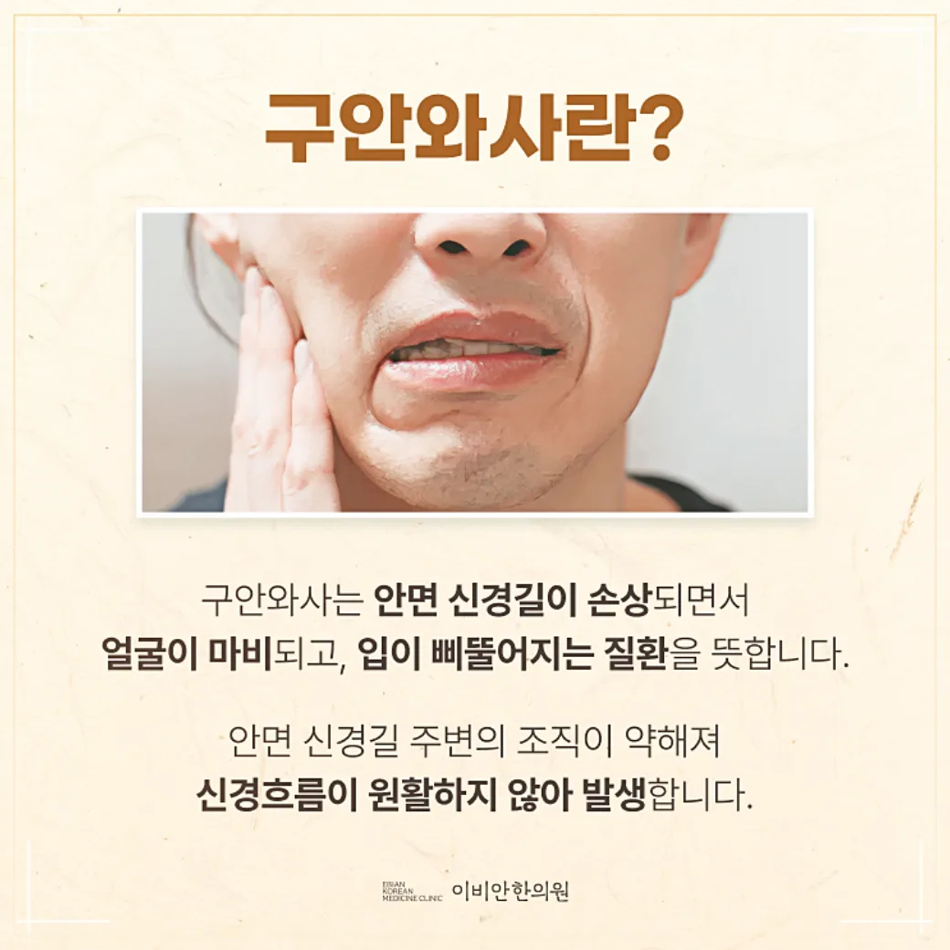 안면마비에 대해 설명하는 이미지