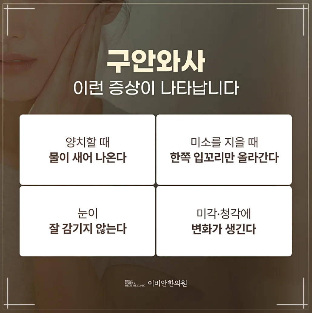 안면마비의 초기 증상 설명하는 이미지
