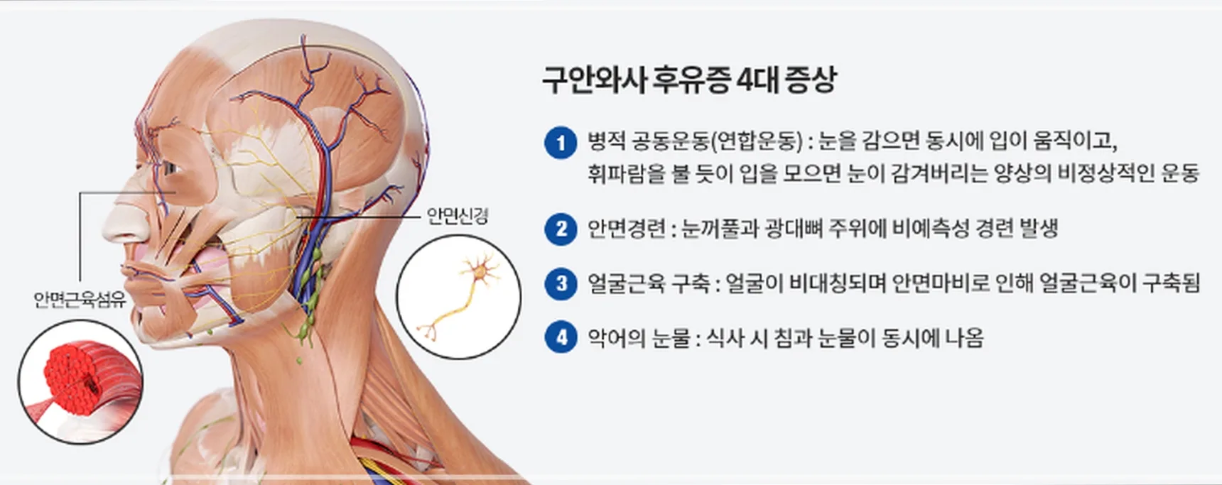 안면마비 1:1 맞춤 진료 및 치료 전략
