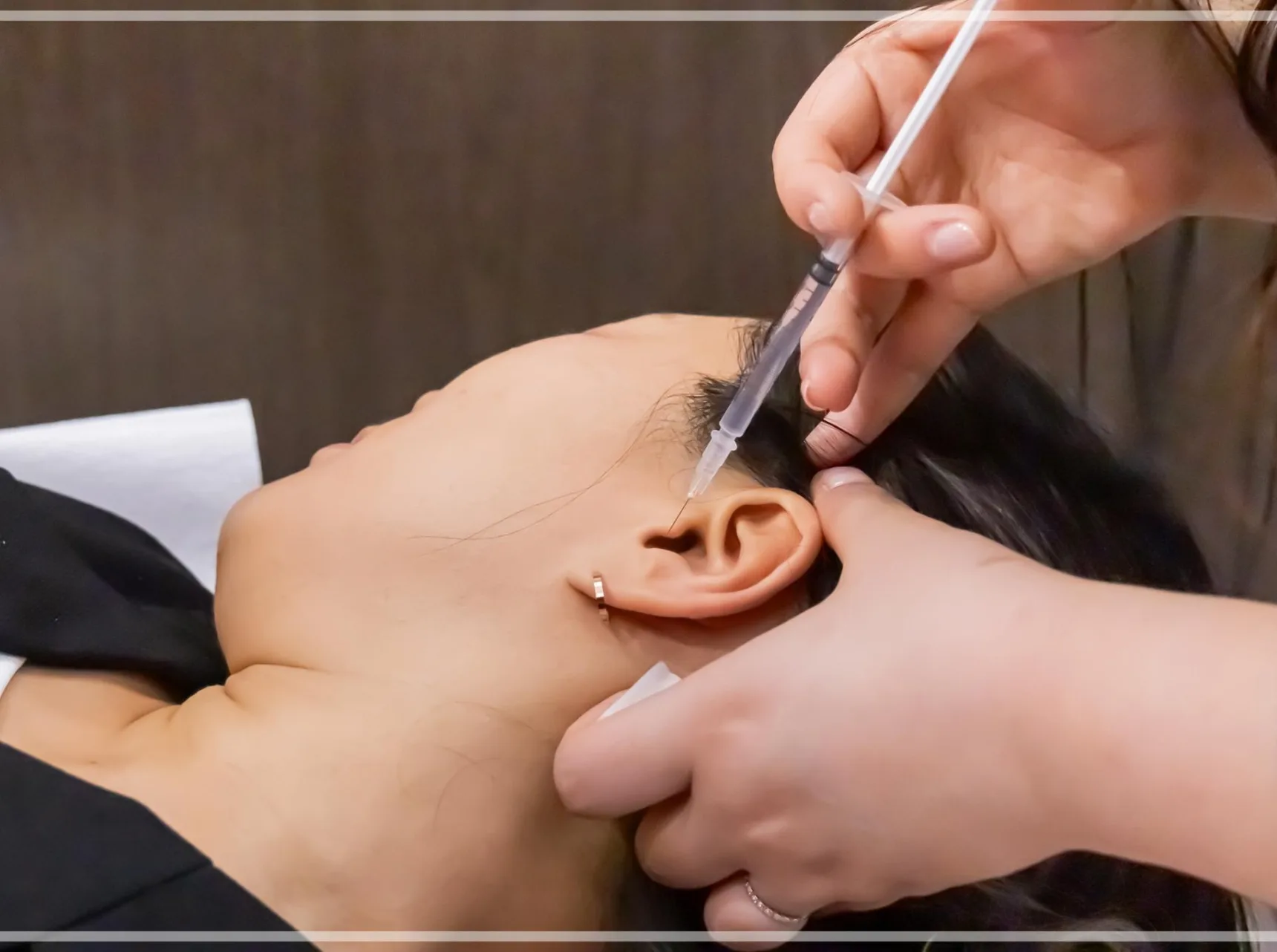 안면마비 증상 치료를 위한 약침