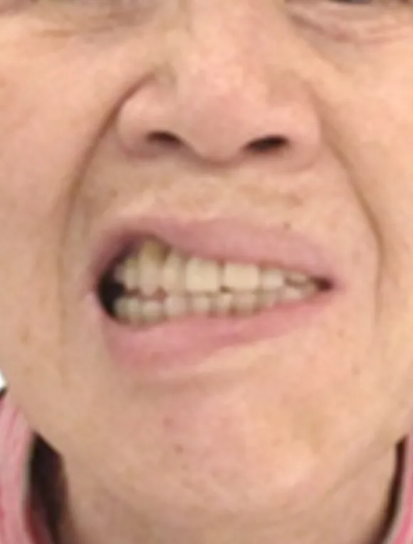 입 주변을 가까이 찍은 사진